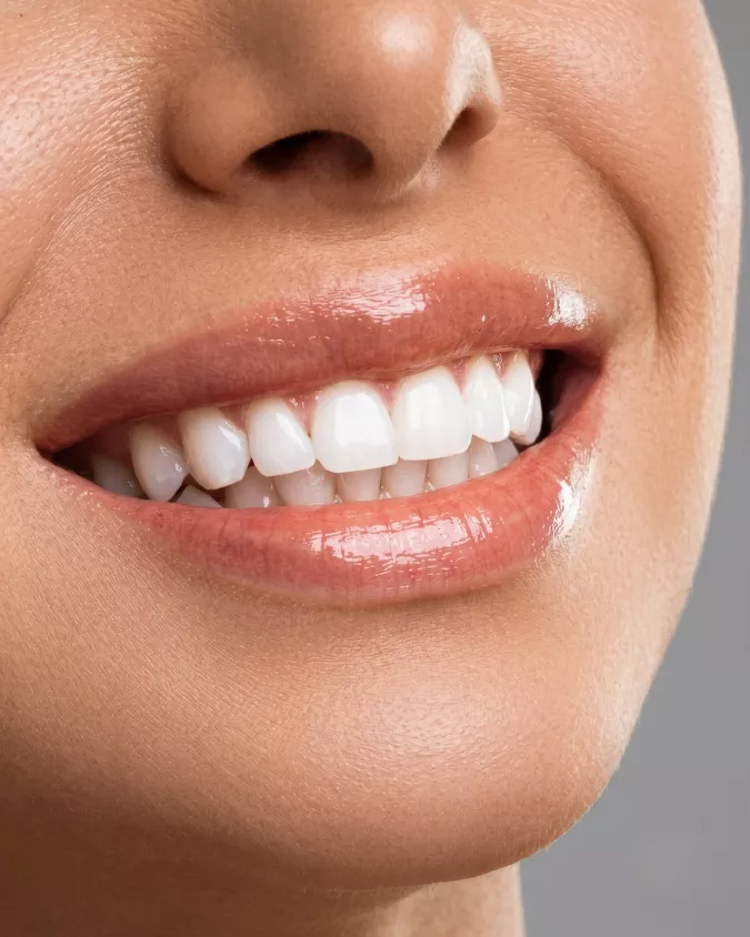 Teeth Whitening
